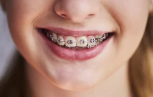 Orthodontiste à Sarrebourg