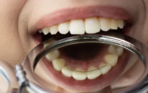 Orthodontiste à Hochfelden