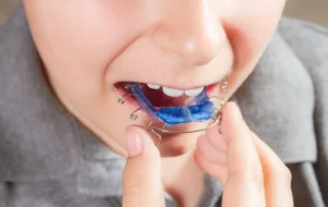 Orthodontiste à Sarrebourg