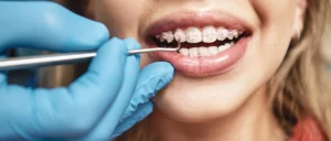 Orthodontiste à Hochfelden