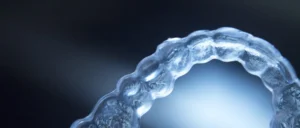 Aligneurs transparents orthodontiste près de Sarrebourg